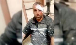 Sokak köpekleri iki kişiyi yaraladı