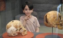 5 bin yıl önce ameliyat edilen kafatası ilgi odağı oldu