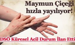 DSÖ, maymun çiçeği virüsü nedeniyle iki yıl içinde ikinci kez küresel halk sağlığı acil durumu ilan etti