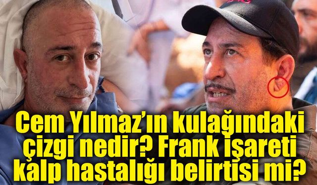Cem Yılmaz’ın kulağındaki çizgi neden gündem oldu? Uzmanlar “Frank işareti”ne dikkat çekti