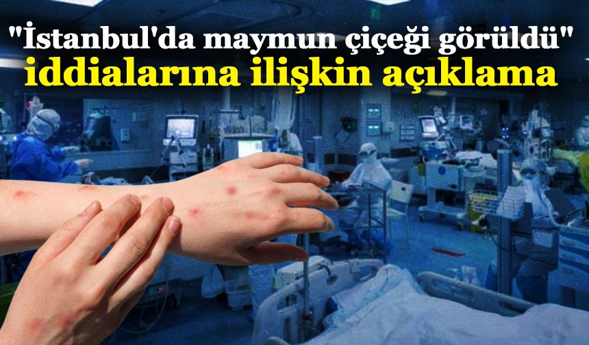 İstanbul İl Sağlık Müdürlüğü'nden "İstanbul'da maymun çiçeği görüldü" iddialarına ilişkin açıklama