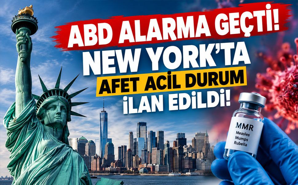 ABD'de kızamık kabusu büyüyor! Vaka sayısı 3 bin 887'ye ulaştı